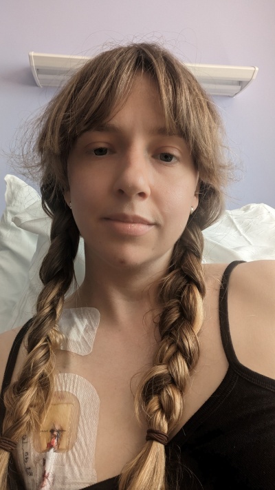 Hannah is sitting in her hospital bed. You can see the port in her chest to receive her cancer treatment. 