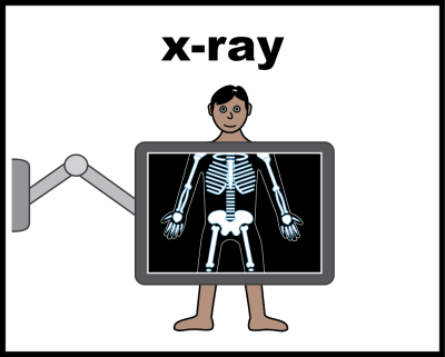 Cartoon of a person having an x-ray to show inside their body
